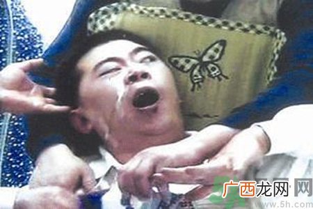 癫痫的发病因素？癫痫的并发症有哪些？