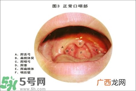 慢性咽炎的治疗方法？慢性咽炎的药物治疗？