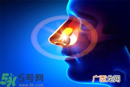 鼻窦炎的高发人群？如何预防鼻窦炎？