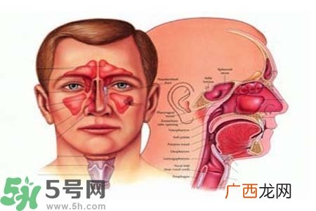 鼻窦炎的高发人群？如何预防鼻窦炎？