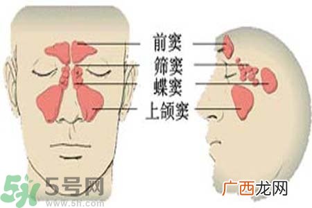 鼻窦炎是什么？鼻窦炎的症状有哪些？