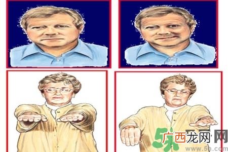 脑中风的发病因素？脑中风的并发症有哪些？