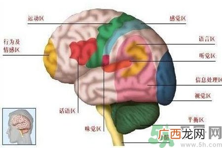 脑出血的发病因素是什么？脑出血的并发症有哪些？