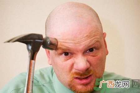脱发的高发人群有哪些？如何预防脱发？