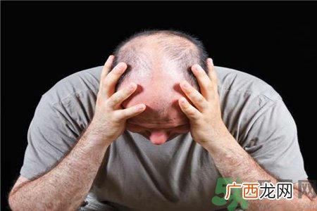 脱发的高发人群有哪些？如何预防脱发？