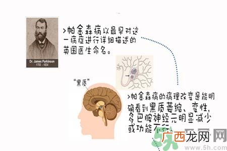 帕金森的治疗方法有哪些?
