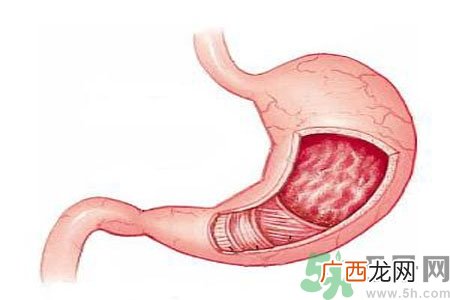 吃完寿司肚子疼怎么办?吃完寿司肚子疼需要注意什么?