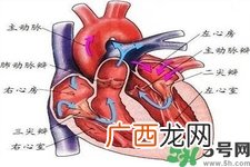 心脏病的症状是什么？心脏病的种类有哪些？