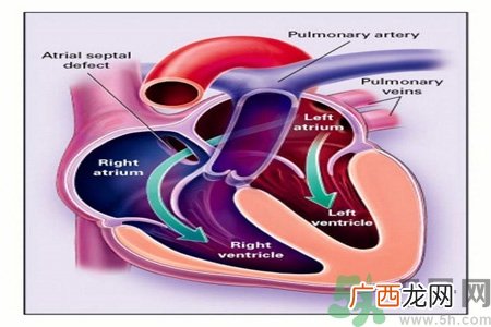 如何预防心脏病？心脏病的禁忌症有哪些？