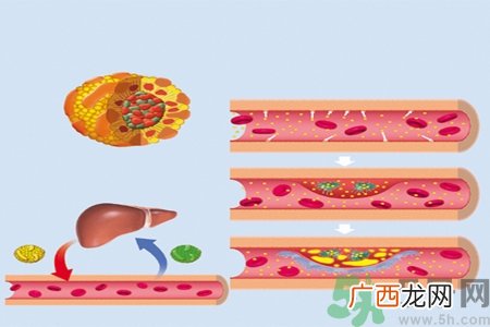 胆固醇对人体有伤害吗？胆固醇是什么？