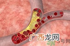 胆固醇对人体有伤害吗？胆固醇是什么？