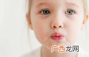 鼻子痒是怎么回事？鼻子痒是过敏性鼻炎吗？