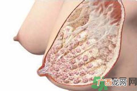 乳腺增生治疗方法是什么？乳腺增生的检查方法有哪些？
