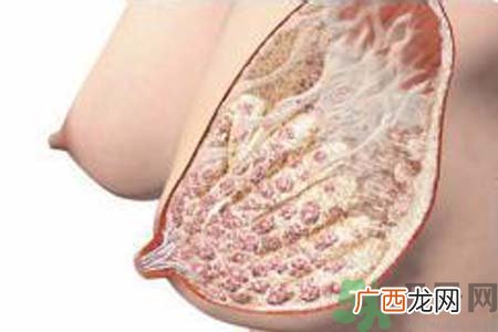 乳腺增生可以怀孕吗？如何预防乳腺增生？
