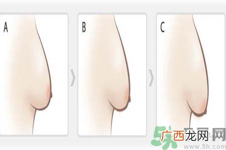 胸部松弛的原因是什么？胸部松弛该怎么办？