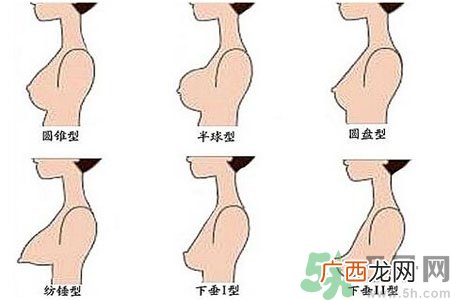胸部松弛的原因是什么？胸部松弛该怎么办？