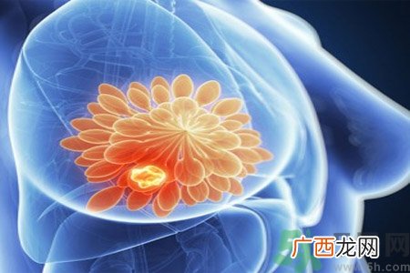 乳房有硬块正常吗？乳房有肿块怎么回事？
