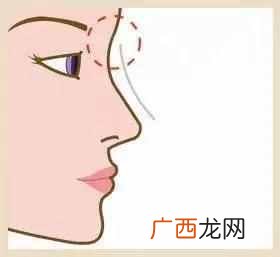 鼻子一般多高不算塌鼻 塌鼻梁大鼻子怎么办