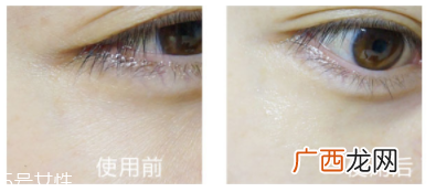 shangpree香蒲丽眼膜适合多大年龄？任何年龄