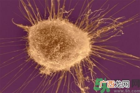 阴道干涩是什么？阴道干涩的危害有什么？