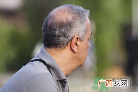 男性更年期的症状有哪些？如何知道是否属于男性更年期？