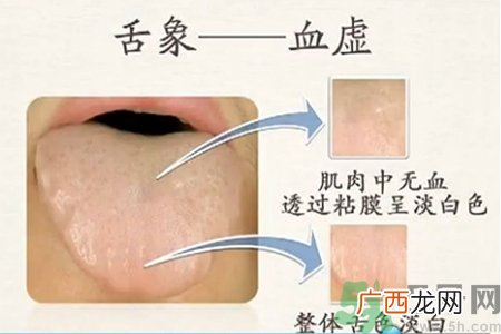 血虚怎么调理？女人血虚怎么调理？