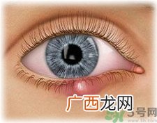 眼皮里长了个疙瘩是怎么回事?眼睛里长了个小白点怎么办?