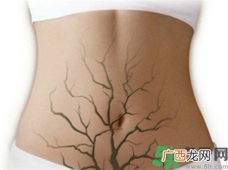 白带发黄是什么原因?白带发黄有异味怎么治?