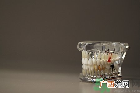 牙周炎有哪些症状?得了牙周炎怎么办