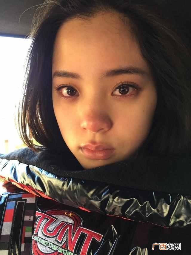 塌鼻子加蒜头鼻 蒜头鼻塌鼻梁怎么办