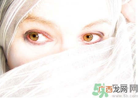 散光和近视的区别散光的症状有哪些？
