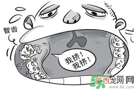 智齿横着长怎么办？智齿横着长一定要拔了吗？