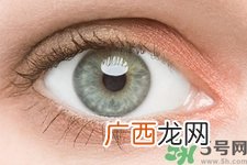 黑眼圈是怎么形成的？黑眼圈是什么原因引起的？