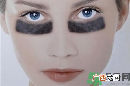黑眼圈是怎么形成的？黑眼圈是什么原因引起的？