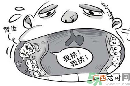 智齿拔了好不好？智齿能不拔吗？
