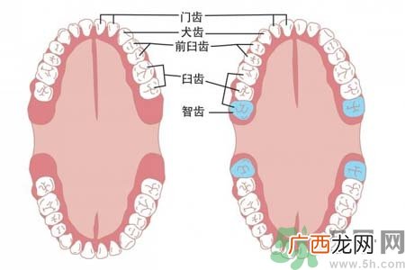 智齿拔了好不好？智齿能不拔吗？