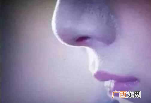 黑头怎么去除最有效发（学生顽固黑头该怎么去
