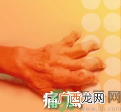 骨关节炎能治好吗？骨关节炎平时注意事项