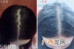 柳屋生发水有用吗？一个月后长出新发
