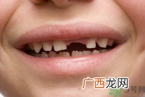 牙齿横着长怎么办?智齿横着长一定要拔吗?