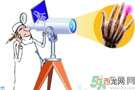 什么年龄测骨龄最好?如何测骨龄?
