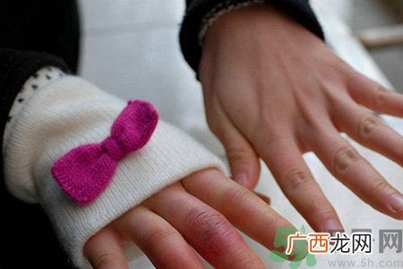 冻疮为什么容易复发？冻疮反复发作怎么办？