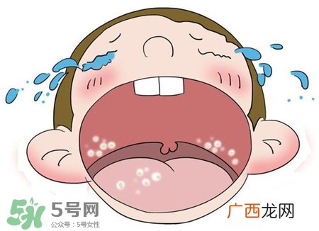 鹅口疮是上火吗?鹅口疮是怎么引起的?