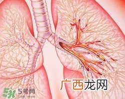 支气管炎吃什么药有效?支气管炎如何根治