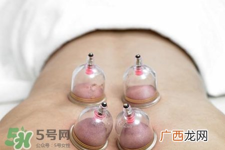 冬天拔罐好还是刮痧好？冬天刮痧和拔罐哪个效果好？