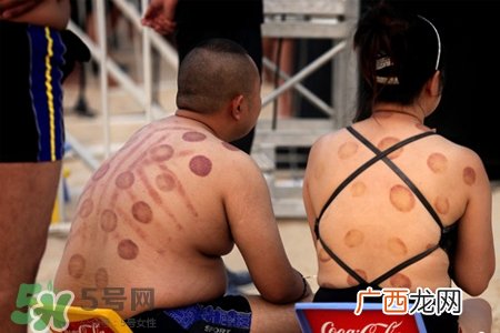 冬天拔罐好还是刮痧好？冬天刮痧和拔罐哪个效果好？
