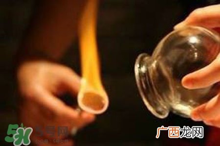 冬天拔罐好吗？冬季最好不要拔火罐