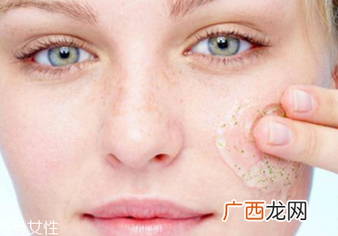 痘痘肌可以去角质吗？不严重时可以去角质