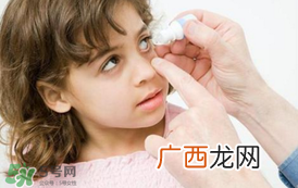 春天眼睛痒怎么办？一到春天眼睛就会痒是怎么回事？