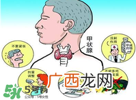 甲亢是怎么引起的？甲亢的早期症状